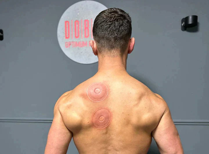 SmartCup - Red Light & Heat Therapy Cupping Massager