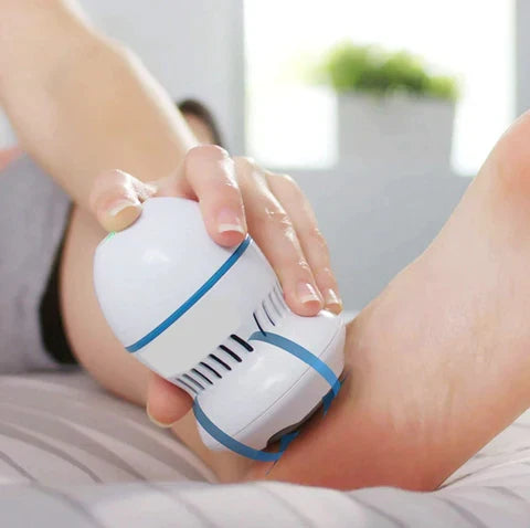 Vacuum Callus Remover - Electric Foot File for Dead Skin